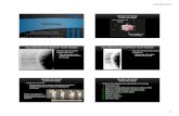 Extravaganza Radiology - Copymedia.scuhs.edu/extravaganza/speaker_uploads/Dr._Rivera...10/28/2013 9 36 YOM W/ TRAUMA AND WRIST PAIN 36 YOM W/ TRAUMA AND WRIST PAIN SCAPHOID FRACTURE