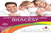 DOES MY CHILD REALLY NEED BRACES? · needs braces. First of all, kudos to you for taking the ˜rst step in seeking more information and ˜nd-ing an answer to your question. It is
