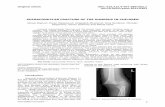 SUPRACONDYLAR FRACTURE OF THE HUMERUS IN CHILDREN · 2018-07-18 · supracondylar fractures in children still remains a great challenge for the pediatric orthopedic surgeons. A possible
