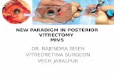 NEW PARADIGM IN POSTERIOR VITRECTOMY MIVS · MIVS related complications Hypotony, Choroidal detachment, Endophthalmitis. Conclusion • The development of MIVS has provided surgeons