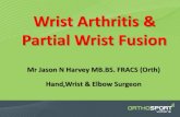 Wrist Arthritis & Partial Wrist Fusion · SLAC Wrist SLAC Wrist ... SLAC/SNAC wrist or fracture Rheumatoid arthritis . Wrist Reconstructive Options Early stage disease, more as a