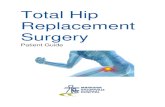 Total Hip Replacement Surgery · Total Hip Replacement Surgery Guide 8 Hip Replacement Patients may ask questions about hip replacements. Below you will find some of the most frequently