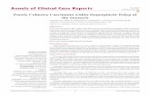 Annals of Clinical Case Reports Case Report · combined signet ring cells and pleomorphic eosinophilic cells, raised . in a gastric hyperplastic polyp and associated with foci of