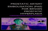 PROSTATIC ARTERY EMBOLISATION (PAE) FOR BENIGN … … · Benign Prostate Hyperplasia (BPH) is the most common disease of the prostate and is very common in middle-aged and elderly