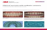 Clinical success with esthetic veneers · Fig. 8: Post-op veneer makeover Fig. 7: Veneers seated with 3M™ RelyX™ Veneer Cement Fig. 9: Post-op smile makeover Fig. 6: Within a