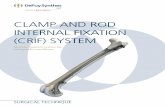 CLAmP AND rOD INTErNAL fIXATION (CrIf) SYSTEm...4 DePuy Synthes Vet Clamp and Rod Internal Fixation (CRIF) System Surgical Technique In 1958, the AO formulated four basic principles,