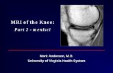 MRI of the Knee - Amazon S3...• recognize at least five imaging pitfalls that may mimic a meniscal tear on MR images. Lecture Outline • Normal anatomy / variants • Meniscal tears