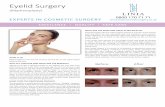 ES LINIA Eyelid Surgery · 2018-09-20 · To improve the deep nose-to-mouth lines. It can be performed through a small incision in smile lines. It enhances the cheek area and reduces