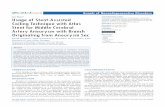 Case Report Usage of Stent-Assisted Coiling Technique with ... · Sometimes it is necessary to pass a microcatheter through the aneurysm sac to navigate the microcatheter to a branch