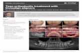 Teen orthodontic treatment with Invisalign aligners · Invisalign ® case report series Initial records: Dr. Sean Holliday (Oahu, HI) Dr. Sean Holliday is a graduate of University