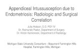 Appendiceal Intussusception due to Endometriosis ... · Introduction. Intussusception of the appendix is a rare occurrence with reported rates of 0.01% in patients who have had an