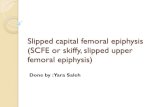 Slipped capital femoral epiphysis (SCFE or skiffy, slipped ...€¦ · SCFE is the most common hip disorder in adolescence. SCEF is a medical term referring to a fracture through