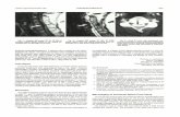 AJNR:8, September/October 1987 CORRESPONDENCE 925 · 4. Atlas SW, Regenbogen V, Rogers LF, Kwang SK. The radiographic characterization of burst fractures of the spine. AJNR 1986;7:675-682,