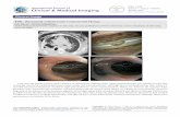 : C olume ssue Clinical Medical Imaging anuary ttpd.doi ... · : C olume ssue anuary linial Iage ttpd.doi.org1.1icmi.11 International Journal of Clinical Medical Imaging Title: Rheumatoid