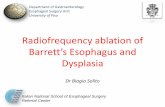 Radiofrequency ablation of Barrett s Esophagus and Dysplasia · • Older age, co-morbidities HGD in BE EAC in BE - uT1m (Early) Esophageal Cancer: Therapy Esophagectomy has been