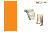 Surgical Technique - Smith & Nephew · 9 3.5mm Medial Distal Tibia Locking Plate •Smooth distal tip minimizes soft tissue irritation over the medial malleolus •2.0mm – 1.5mm