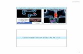 Colorectal Cancer and FDG PET/CT - University of Pretoria 2017 Lectures... · Hybrid imaging in colorectal & esophageal cancer Emmanuel Deshayes IAEA WorkShop, November 2017 Colorectal