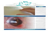 vayasalamat.com · VAYA Salamat . azs CXL (Corneal collagen cross— linking) 135 ( Keratoconus . ( 9 ( Hard Contact Lens)