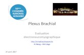 Plexus Brachial · 2017-04-24 · Plexus Brachial Evaluaon électroneuromyographique FC Wang – CHU Liège 15 avril 2017 h:p://enmgblog.blogspot.be Introduc0on ! Région d’exploraon