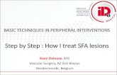 Step by Step : How I treat SFA lesions · Vascular Surgery, AZ Sint Blasius Dendermonde, Belgium. Created Date: 1/26/2017 6:49:09 PM ...