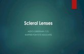 Scleral Lenses - Midwest Optometric Society · Scleral Lenses Definition: A large gas permeable contact lens that rests fully BEYOND the limbus and may generally range from 15.0-21.0mm