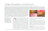 Atopic Dermatitis: An Overview - AAFP Home 2012. 7. 1.آ  Atopic dermatitis, also known as atopic eczema,
