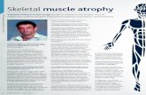 Skeletal muscle atrophy - University of Florida · Skeletal muscle atrophy can be caused by a number of factors which range from involuntary disuse – due to bed-rest or spinal cord