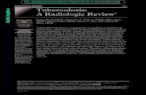 Tuberculosis: A Radiologic Review - UNC Medical Student ...msrads.web.unc.edu/files/2018/08/TB-Radiology-Review.pdf · Protection of the Health Care Worker Tuberculosis is an airborne