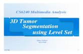 3D Tumor Segmentation using Level Setcs6240/past-projects/3d-tumor-seg/3… · 04/27/2006 1 CS6240 Multimedia Analysis 3D Tumor Segmentation using Level Set Sima Taheri 04/27/2006