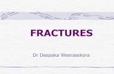 FRACTURES - Weebly19thbatch.weebly.com/uploads/2/3/9/4/23941270/fractures.pdfDelayed union Non-Union Mal-Union Shortening Fat embolism Avascular Necrosis Post-traumatic ossifications