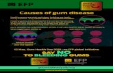 12 May, Gum Health Day 2020 - an EFP global initiative SAY ... · Causes of gum disease accumulates because of poor oral hygiene DENTAL PLAQUE What triggers gum disease is: Risk factors