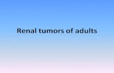 Urinary Tract Tumors - JU Medicine...Wilms Tumor •3rd most common solid cancer < 10 years. •derived from the mesoderm. •sporadic or familial (autosomal dominant). •Mutations: