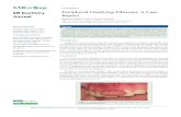 Peripheral Ossifying Fibroma: A Case ReportPeripheral ossifying fibroma is a non-neoplastic enlargement of the gingiva that usually arising from the interdental papilla. A 36-year-old