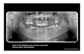 Necrosis - Coltene Brasil: Upgrade Dentistry€¦ · Tooth # 10, Pulp Necrosis and Non‐supurative Chronic apical periodontitis. Case treated by Dr. Ricardo Caicedo
