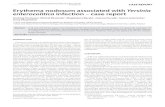 Erythema nodosum associated with Yersinia enterocolitica … nodosum.pdf · Journal of Pre-Clinical and Clinical Research, 2009, Vol 3, No 2, 124-126 CASE REPORT Erythema nodosum