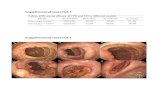 Lippincott Williams & Wilkins · Web viewColonoscopic picture showing scars(2a),patlous ileocecal valve(2b) and transverse ulcer(2c) in patients with intestinal tuberculosis, and