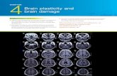 cHaPter Brain plasticity and brain damage...develop understanding of human neurological disorders including Parkinson’s disease. Brain development in infancy and adolescence 147