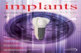 implants - SSER · implants internationalmagazine of oral implantology issn 1868-3207 Vol. 16 • Issue 4/2015 | research Incidence of postoperative infections in dental procedures