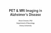 PET & MRI Imaging in Alzheimer’s Diseasealzheimers.emory.edu/documents/combined915.pdfAlzheimer’s disease is the 6th leading cause of death in the United States1 More than 5 million