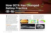 How OCTA Has Changed Retina Practice · OCTA is an important step in this direction. In exudative AMD, OCTA helps to image and confirm the diagnosis of CNV, but it is also a major