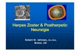 Herpes Zoster &Herpes Zoster & Postherpetic Neuralgia · Post-Herpetic Neuralgia (PHN) in the UK Remy et alHerpetic Neuralgia (PHN) in the UK. Remy et al 10 Annecy, July 2008 The