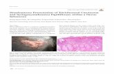 Simultaneous Presentation of Trichilemmal Carcinoma and ... · Simultaneous Presentation of Trichilemmal Carcinoma and Syringocystadenoma Papilliferum within a Nevus Sebaceous Seung