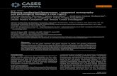 Case report Primary mediastinal liposarcoma - computed ...Primary mediastinal liposarcoma - computed tomography and pathological findings: a case report Fabiana Barroso Thomaz1, Edson
