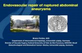 Endovascular repair of ruptured abdominal aneurysms–40% of untreated aneurysms 5.5-6cm or larger will rupture within 5 years –Average survival without treatment: 17 ... or penis;