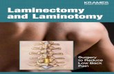 Laminectomy and Laminotomy (PDF) · pressure off nerves in the low back, which greatly reduces symptoms. These surgeries are not cure-alls, but they are especially good at reducing