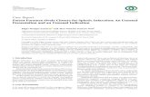 Patent Foramen Ovale Closure for Splenic Infarction: An ...downloads.hindawi.com/journals/cric/2020/9802908.pdf · and consideration for patent foramen ovale closure. Splenic infarction