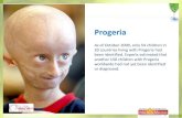 Progeria - swachhtakipehel.comswachhtakipehel.com/images/knowledgehub/Dinesh_Chindarkar_Pro… · Progeria, a rare fatal, rapid-aging disease IS takin the lives of children around