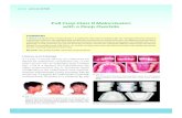 Dr. Sheau-Ling Lin, (left) Full Cusp Class II Malocclusion ...iaoi.pro/asset/files/ijoi_36_pdf_article/072_086.pdf · Overall, this moderately difficult malocclusion (DI=20) was finished