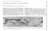 Collagen deposition in liver disease · Ann. rheum. Dis. (1977), 36, Supplementp. 29 Collagen deposition in liver disease J. O'D. McGEE Fromthe DepartmentofPathology, Radcliffe Infirmary,