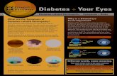 Diabetes + Your Eyes€¦ · cholesterol you will decrease your risk of eye disease. You will also protect your heart, kidneys, feet, ears, and eyes. Eat a healthy diet, get regular